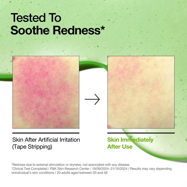 Anua Azelaic Acid 10 Hyaluron Redness Soothing Serum — image 8