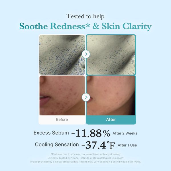 Medicube Azelaic Acid Toner – view 4