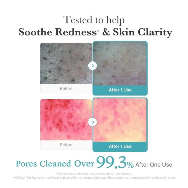 Medicube Azelaic Acid Foam – view 4