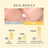 Medicube Kojic Acid Turmeric Brightening Gel Mask