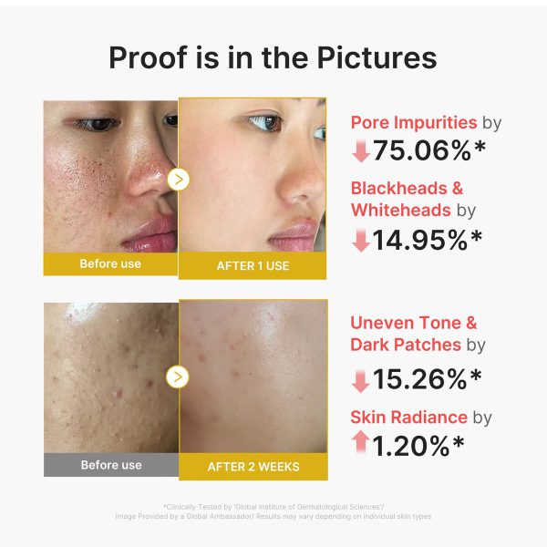 Medicube Kojic Acid Turmeric Peel – view 3