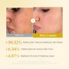 Medicube Kojic Acid Toner – view 3