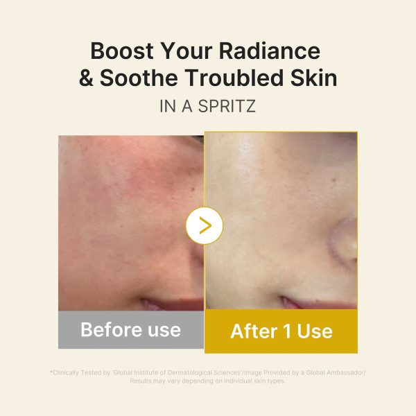 Medicube Kojic Acid Serum – view 4