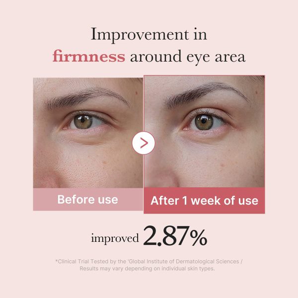 Medicube PDRN Eye Cream – view 4