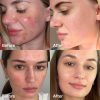 Medicube Red Succinic Acid Serum
