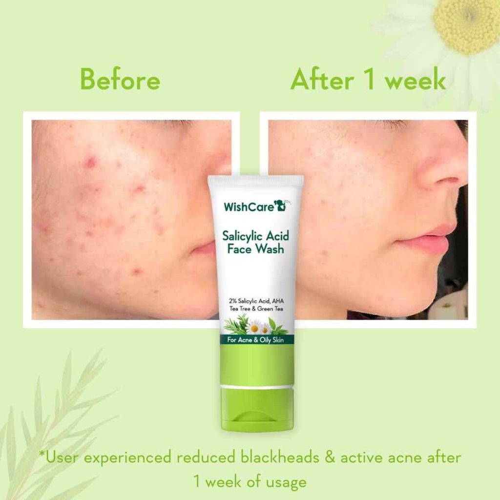 WishCare Salicylic Acid Face Wash