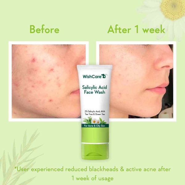 WishCare 2% Salicylic Wash – view 2
