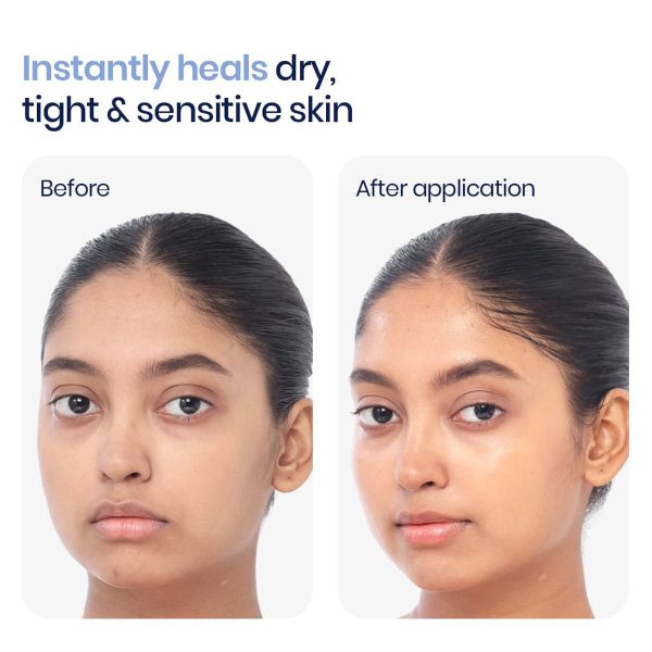 WishCare 3:1:1 Barrier Moisturizer – view 3