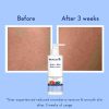WishCare AHA + BHA Body Lotion – 4 WishCare AHA Lotion – view 4