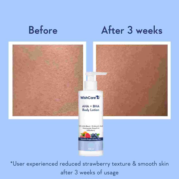 WishCare AHA + BHA Body Lotion – 4 WishCare AHA Lotion – view 4