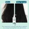 WishCare Ceramide Anti-Dandruff Conditioner – view 3