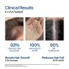 WishCare Hair Growth Serum – view 3