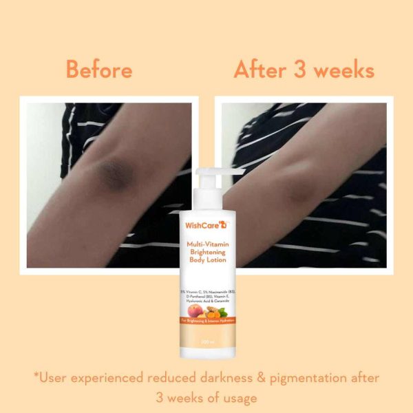 WishCare Multi Vitamin Lotion – view 2