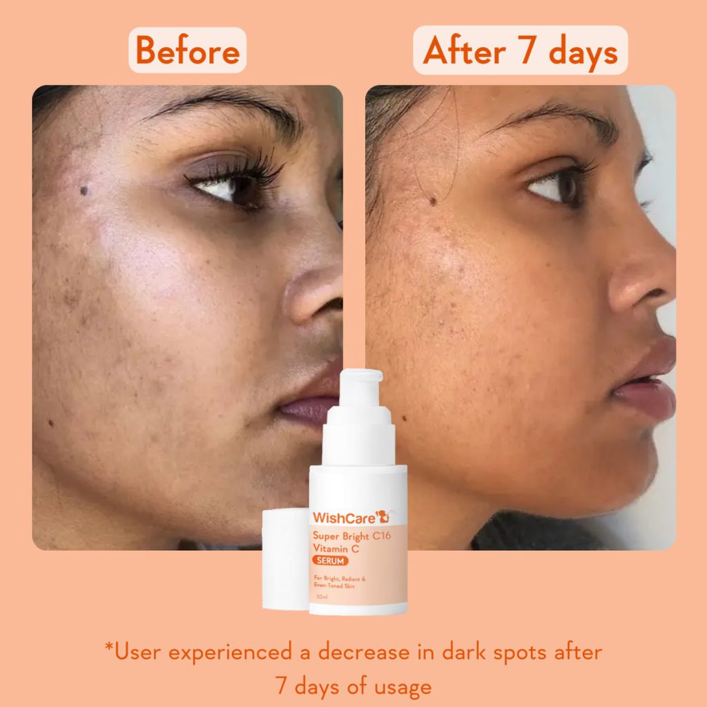 WishCare Vitamin C16 Serum